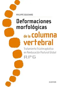 Deformaciones morfológicas de la columna vertebral