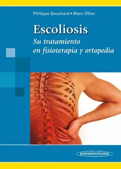 Escoliosis - Su tratamiento en fisioterapia y ortopedia